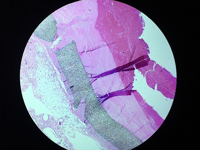 Out of the Frying Pan and onto your Back